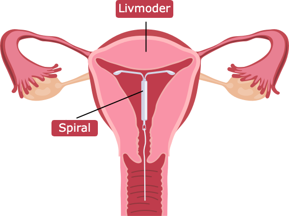 livmodern 4